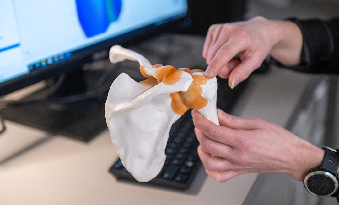A model of the rotator cuff set in a shoulder.