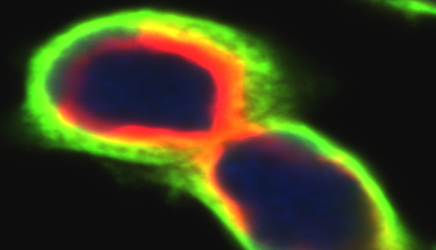 Protein signals under a microscope