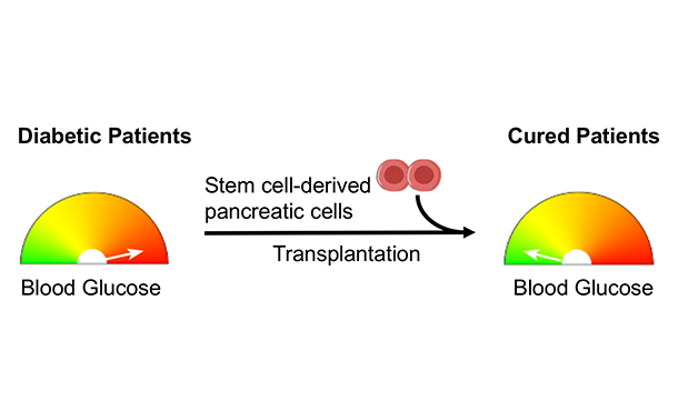 diagram showing improvement in blood sugar levels of diabetic patients through stem cell therapy