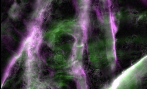 Cellulose in a plant cell wall after labeling with a fluorescent dye, showing differently oriented fibers (magenta and green). 