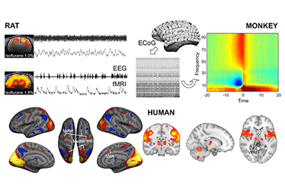 Multimodal and Computational Neuroimaging Lab