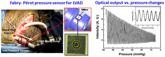 Image of implantable pressure sensor for Left Ventricular Assist device