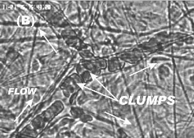 Photo of RBC formation