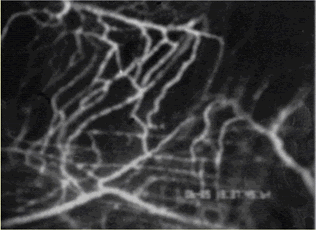 Image of flourescently labeled RBC's